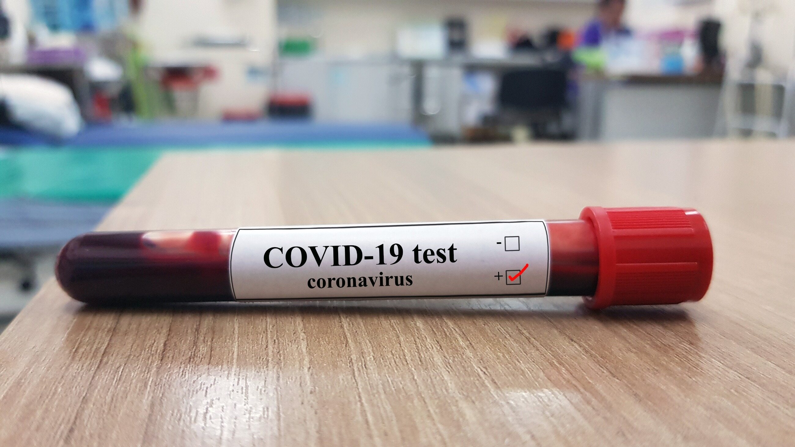 Darmowy Test Na Koronawirusa Warunki Kiedy Jak Ministerstwo Zdrowia 6774